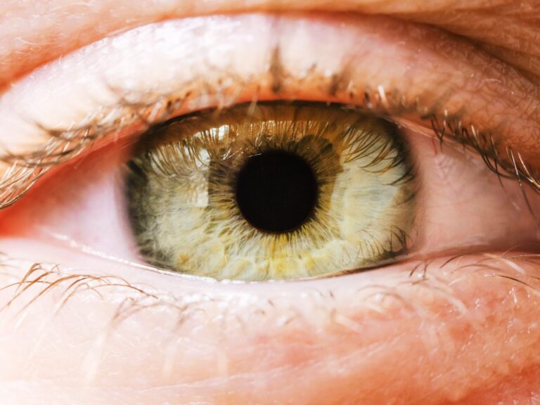 Iridology